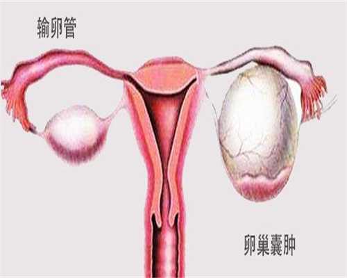 宁波子宫性不孕试管用药指导与供卵三代试管助孕策略示意图